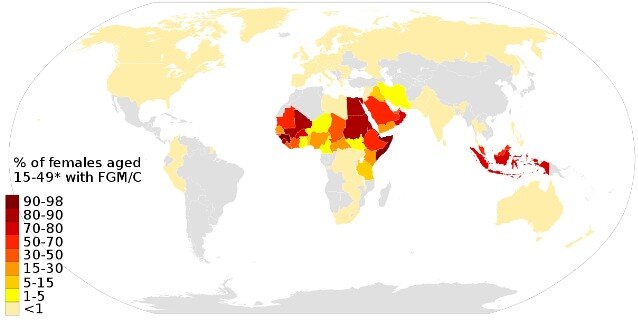 Female genital mutilation